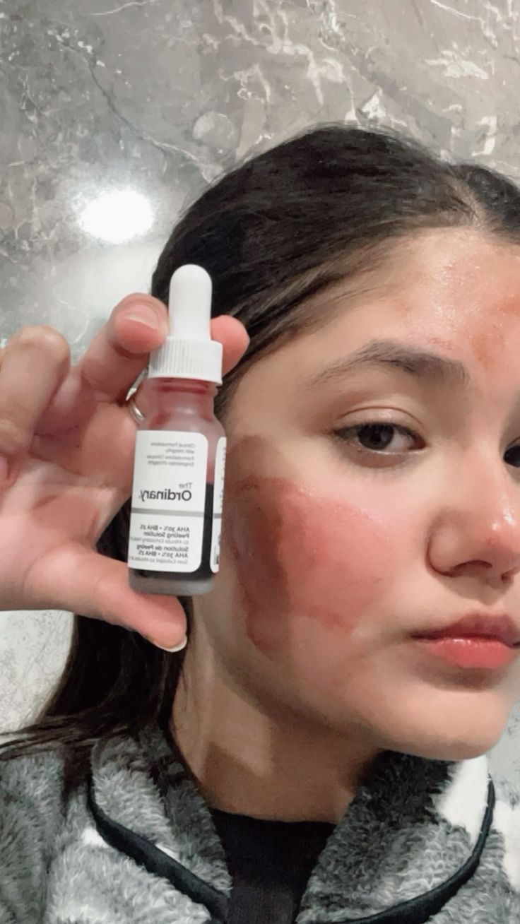 The Ordinary AHA 30% + BHA 2% Peeling Solution – 30ml